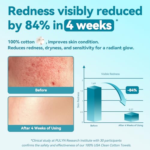 Winner Disposable Face Towel - 480 Count Soft Thick